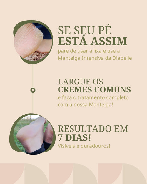 Manteiga Hidratante Intensiva para os Pés